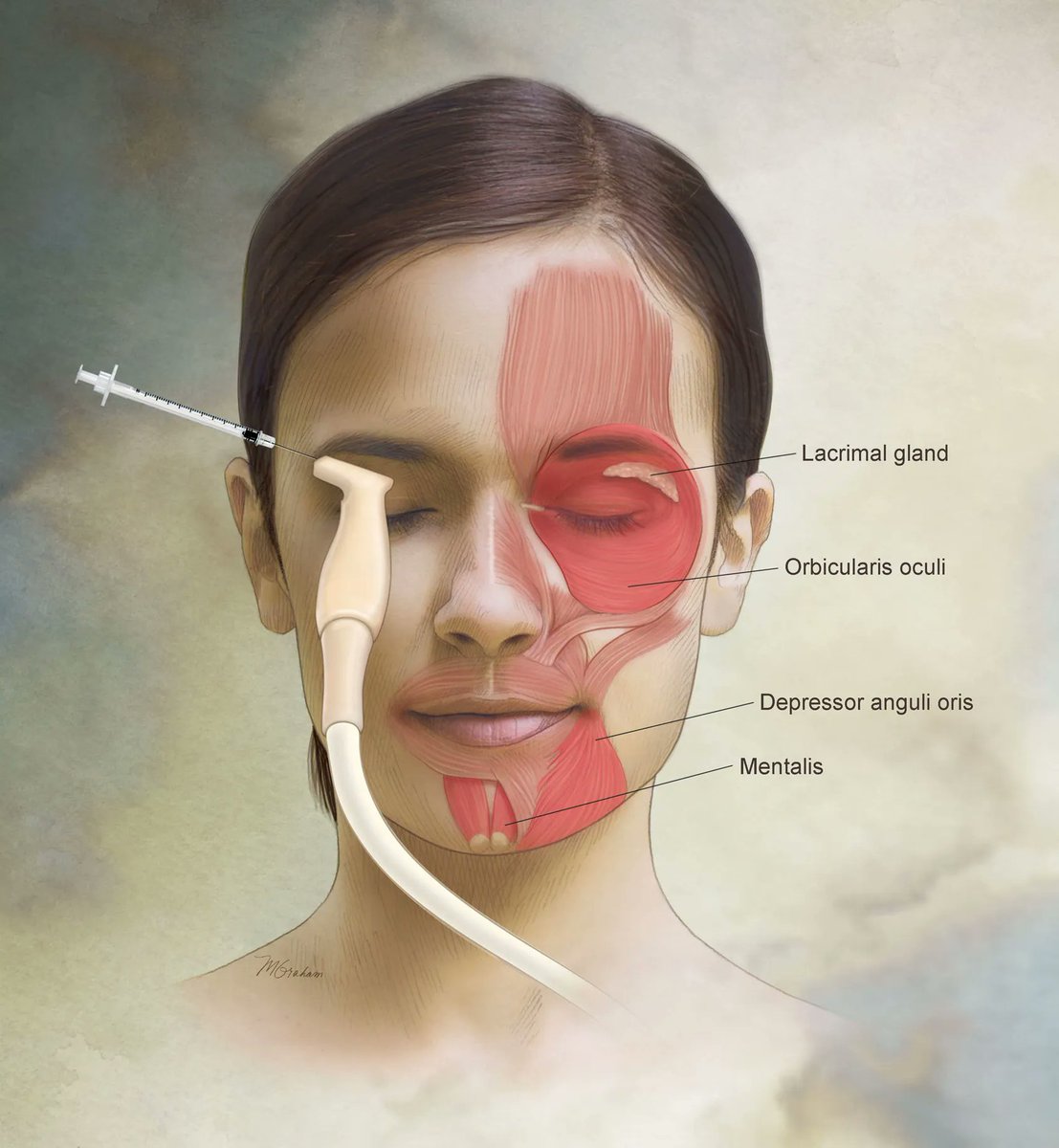 Medillustrates's tweet photo. Michele Graham is a Board Certified Medical Illustrator with 17 years of experience.
Explore her portfolio: https://t.co/MIcNQ2lzVI
#medicalillustrator #medicalillustration #facialmuscles #ultrasound #hypertension #cardiology #neurospace #neurology #muscles #anatomy https://t.co/uG4jRCds6J