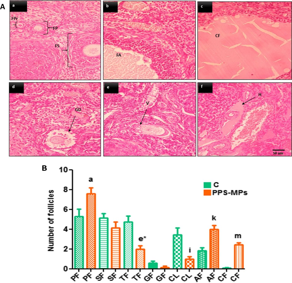 DrSCoffin's tweet photo. Exposure to #microplastics leads to a defective ovarian function and change in cytoskeleton protein expression in rats.
#FemaleReproduction #Fertility

https://t.co/ssuofPgv7a https://t.co/RQfk9ZPyRP