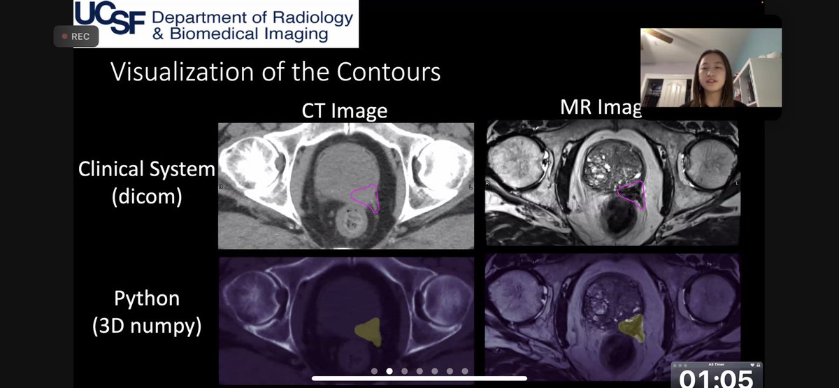 Jess Scholey tweet media