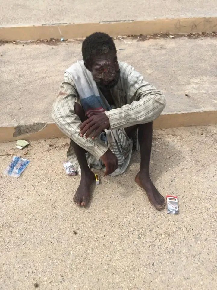 Cet homme est gravement malade. Ça fait plusieurs jours qu'il a élu domicile à la place place Faidherbe. D'après les informations reçues ' Il a été interné à l'hôpital régional de Saint-Louis, avant d'être libéré. ' Crédit photo : Bolisto Diaw #Senegal @ligueblogsante #kebetu