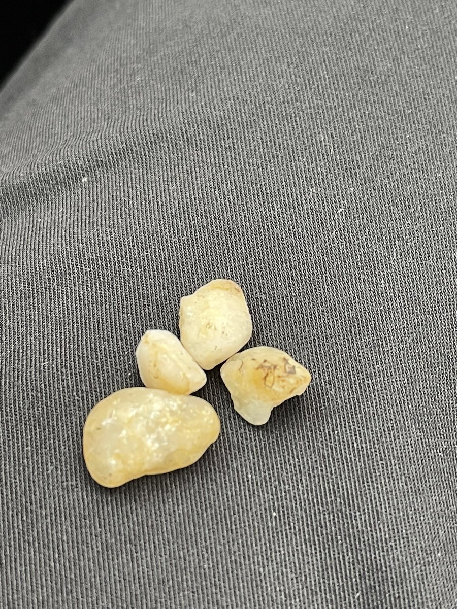 agrimes68's tweet photo. This is how you know you work in Pediatrics. Rocks left by my patient in an exam room. #MedTwitter #Pediatrics #kidsloverocks https://t.co/hZ8IIy8tHn