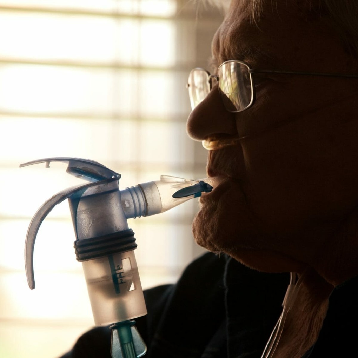 The PI*ZZ and PI*SS genotypes seem to be associated with #ChronicObstructivePulmonaryDisease (#COPD) in patients with #Alpha1AntitrypsinDeficiency (#AATD), according to a study in @TurkThoracJ. fal.cn/3rbg2 #LungTwitter #LiverTwitter #AATDAwareness #RareDisease