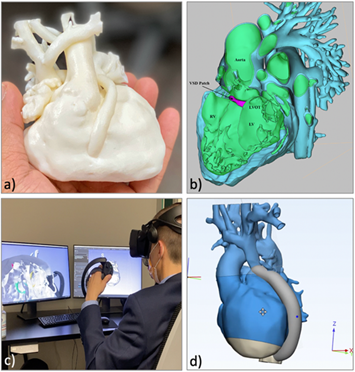 FrankRybicki's tweet photo. Great article in #3DPrintMed reviews growth and development of clinical 3D modeling services + planning within pediatric heart center. Article here:  https://t.co/0gHlGECIuY   @ClinMedJournals @BioMedCentral @SpringerNature @Formlabs @3DPrinting @AdditiveManufacturing https://t.co/63wVTFN0iu