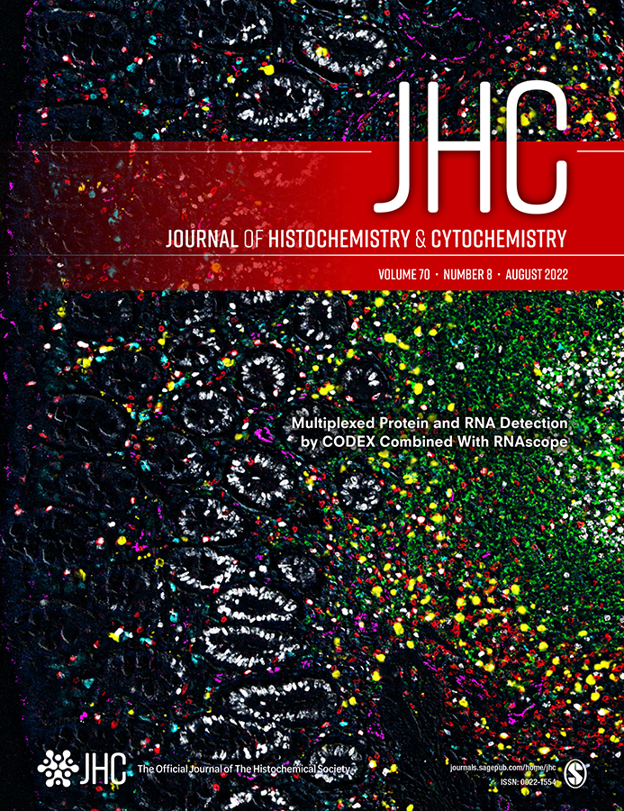 histochemnews's tweet photo. The new August 2022 issue of @JHCnews is now available online!
Check out the latest articles at https://t.co/dqol9tvjkl
#Science #Histochemistry #Cytochemistry https://t.co/K6Uis1fAU2