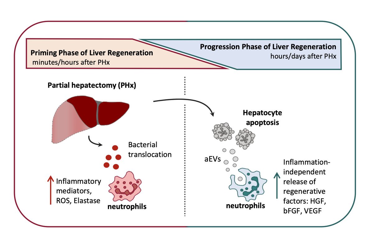 One of my absolute favourite projects - we found that neutrophils change their phenotype from inflammation to regeneration/healing after exposure to apoptotic vesicles from hepatocytes - our hint was ALPPS as massive source of apoptotic vesicles.

journal-of-hepatology.eu/article/S0168-…
