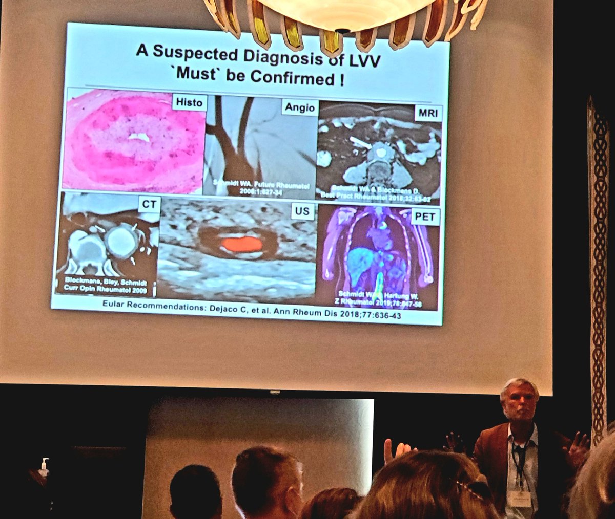 minnakohlermd's tweet photo. Dr. Wolfgang Schmidt: a suspected diagnosis of Large Vessel Vasculitis must be confirmed! #vasculitis #ultrasound #POCUS #RheumTwitter #rheumatology #meded #FOAMed  @USSONAR_Rh @MGH_MSUS https://t.co/yLwL0Afs85