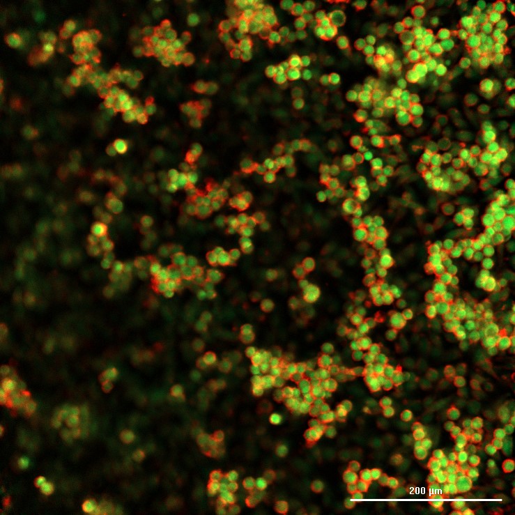 Biohubx's tweet photo. We are so excited to share these images with you! 😊

These were taken with our new Cytation C10, and they are images of stained breast cancer cells. Now that this confocal imager is operational, please contact us to find out how you can take images like these!

#lifesciences https://t.co/1L8Z4l6mg5