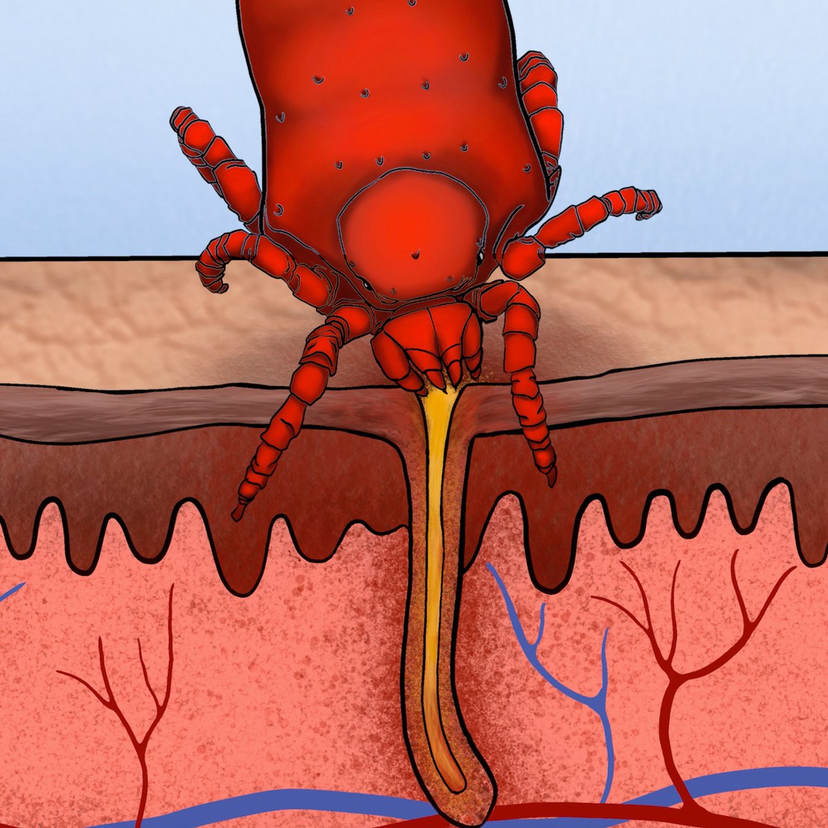 Coyote Peterson (@coyotepeterson) on Twitter photo EATEN ALIVE! By CHIGGERS! Tomorrow I head barefoot into the forest to see if I can get myself attacked by a swarm of chiggers! Spoiler alert: the result is NOT YouTube friendly!! It’s time to be bitten up by invisible monsters and put <a href="/StingKill/">Sting-Kill</a> Chiggerex to the test. EATEN ALIVE! By CHIGGERS! Tomorrow I head barefoot into the forest to see if I can get myself attacked by a swarm of chiggers! Spoiler alert: the result is NOT YouTube friendly!! It’s time to be bitten up by invisible monsters and put <a href="/StingKill/">Sting-Kill</a> Chiggerex to the test.