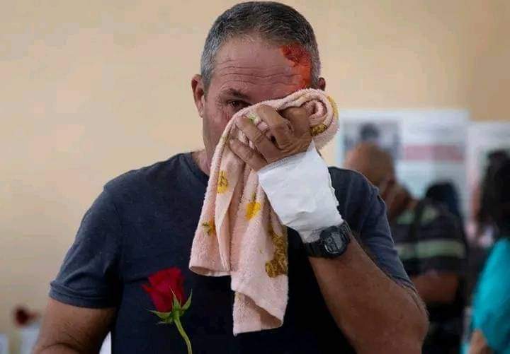 #MatanzasNoEstaSola el dolor se comparte. #CubaHonra