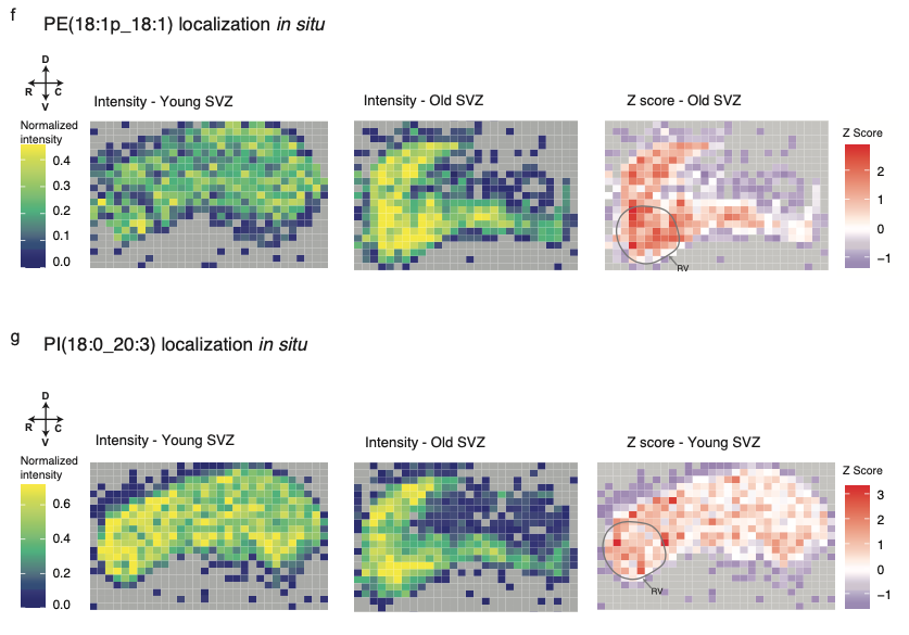 xiaoaizh's tweet photo. #SpatialLipidomics by DESI-MSI allowed us to assess lipidomic changes on rare cell populations in native tissues, such as the NSCs. We confirmed that complex membrane lipids are affected in quiescent NSCs during aging in situ. https://t.co/TKJcGLKtFh