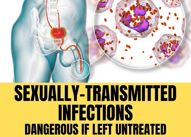 the_beardedsina's tweet photo. Sexually transmitted infections are  becoming worrisome

Here are 5 STI you should know about, what to do. See if you have any symptoms and try and go to a hospital

Please share https://t.co/xytPVNq0MU