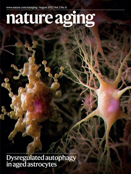 Won-Suk Chung (@wonsukchung) on Twitter photo Our recent work "A distinct astrocyte subtype in the aging mouse brain characterized by impaired protein homeostasis" made it to the Cover of <a href="/NatureAging/">Nature Aging</a> August issue!
Volume 2 Issue 8, August 2022 - nature.com/nataging/volum… Our recent work "A distinct astrocyte subtype in the aging mouse brain characterized by impaired protein homeostasis" made it to the Cover of <a href="/NatureAging/">Nature Aging</a> August issue!
Volume 2 Issue 8, August 2022 - nature.com/nataging/volum…