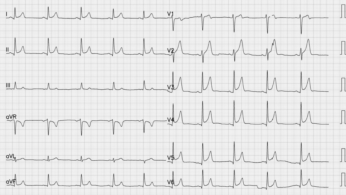 Robert Herman, MD, PhD tweet media