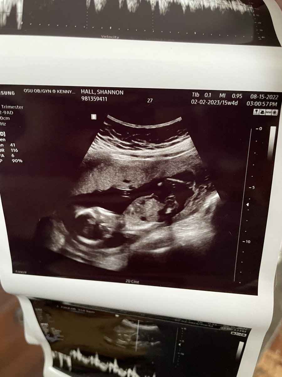 ShannonBeeHall's tweet photo. I think I forgot to tell twitter I’m pregnant, with twins! 👯‍♀️ https://t.co/oeMAYF2wWO