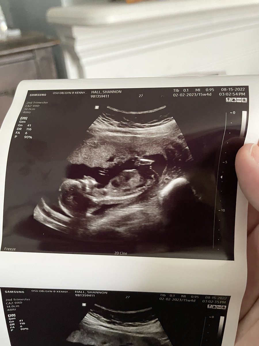 ShannonBeeHall's tweet photo. I think I forgot to tell twitter I’m pregnant, with twins! 👯‍♀️ https://t.co/oeMAYF2wWO