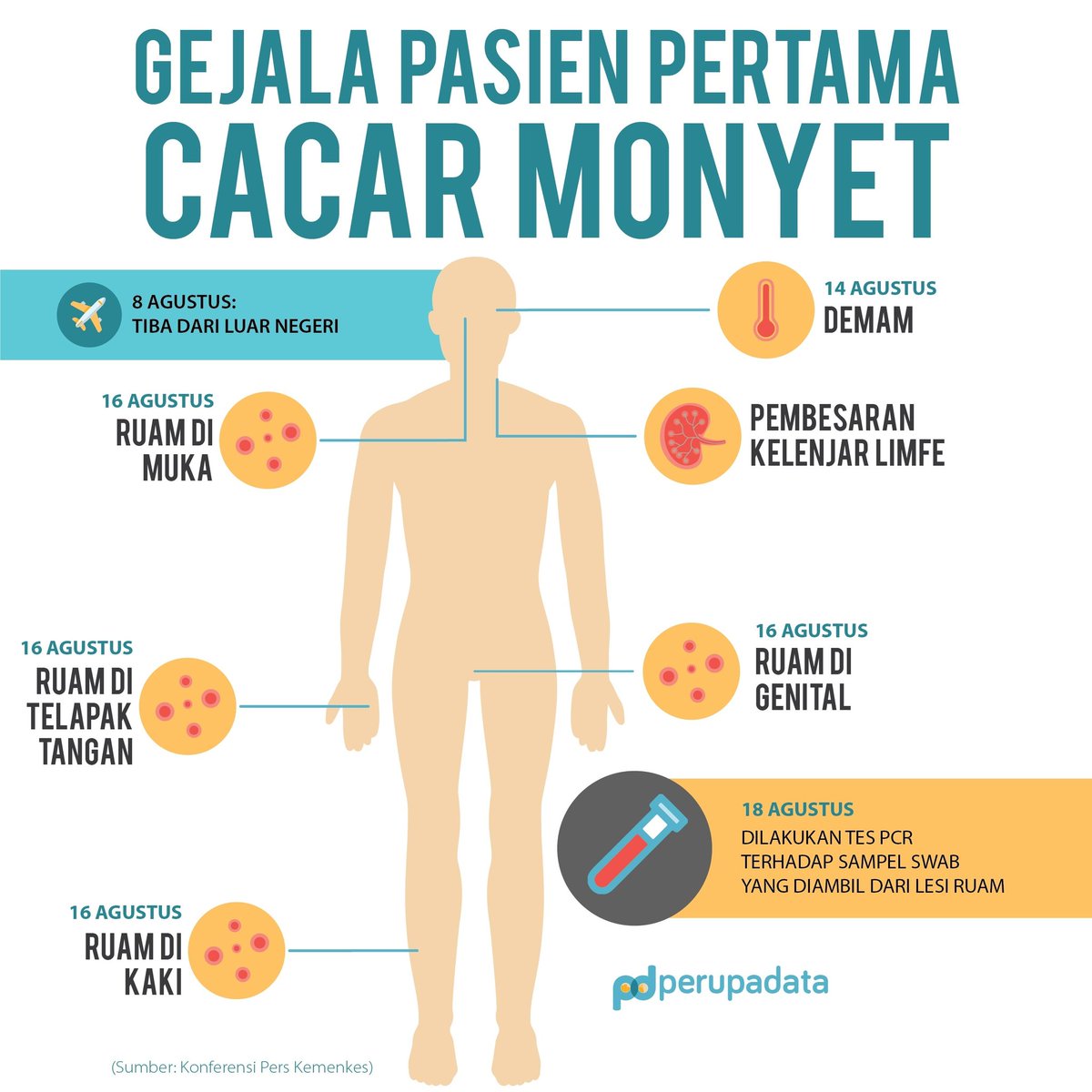 perupadata's tweet photo. Ini yang dialami pasien pertama cacar monyet di Indonesia. https://t.co/wsAdHmd46V