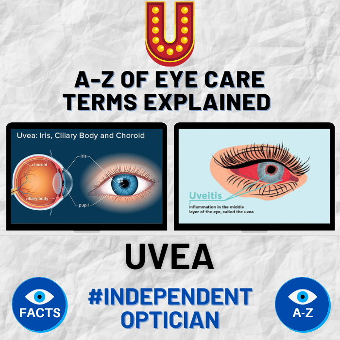 The Uvea is the middle layer of the eye, consisting of the iris, ciliary body and choroid. It can sometimes become inflamed causing the usually painful condition that is known as uveitis. #Uvea #Uveitis #Optician #EyeTerms