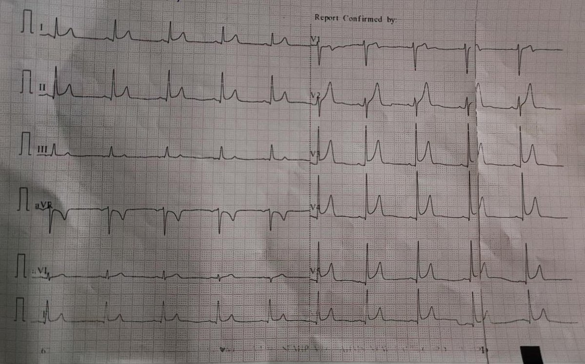 Adil Rashid MD tweet media