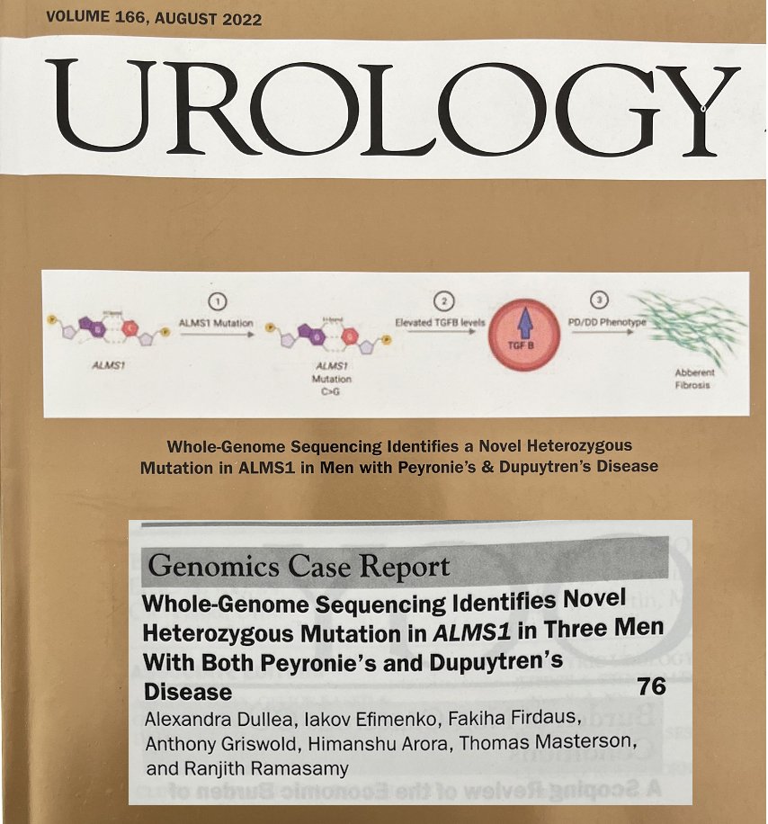 Excited to see my first, first-author publication in print! Understanding the Peyronie’s Disease genetic landscape is necessary to improving our knowledge of PD and patient outcomes. 


Thank you to @ranjithramamd and #ramasamyteam for continued support and guidance!