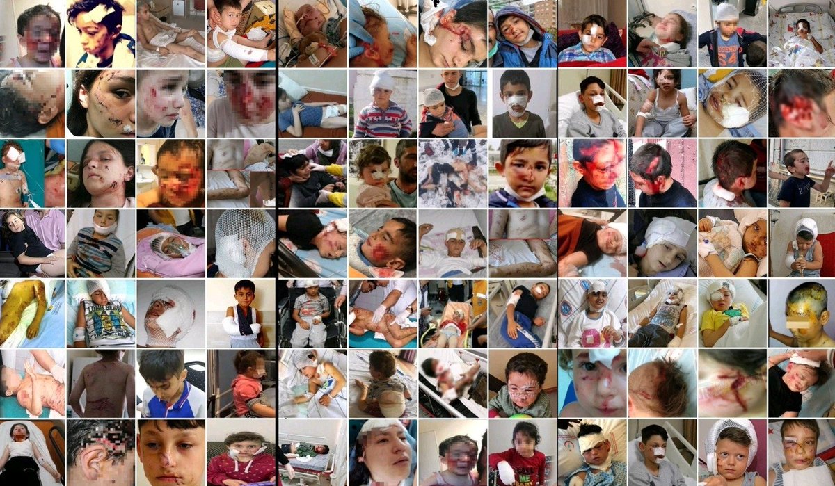 <a href="/MetinUca/">Metin Uca</a> Bu çocukların hepsini başıboş köpekler parçaladı. Çoğu kafasından ağır yaralandı, bazıları öldü. Başka çocuklar ölmesin diye açılan @havritacom başıboş köpek haritasıdır. Başıboş köpek sorunundan şikayetçi ve mağdur insanların veri girdiği bir araçtır. #HaVritaHayatKurtarır