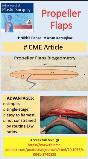 JournalPlastic's tweet photo. @IJPS #eFirst presents to u a #CME article on #PropellarFlaps- The New Vogue in Pedicled #flaps! Click on the link to know the key points 🤫 for successful harvest. 
https://t.co/rDMt5Jhon7 https://t.co/uq2Dg25EDk