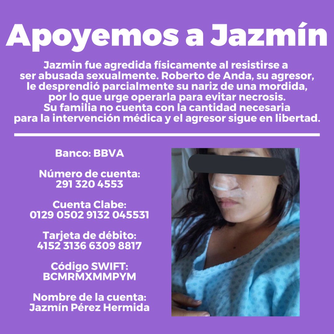 brujasdelmar's tweet photo. Urge que Jazmín sea operada para reconstruir su nariz derivado del ataque que perpetró en su contra Roberto de Anda, corre riesgo de necrosis y sus familiares no pueden absorber los gastos mientras ese infeliz no da la cara.

¡Cada peso ayuda, compartir también es apoyar! https://t.co/U17YQ6WyL2