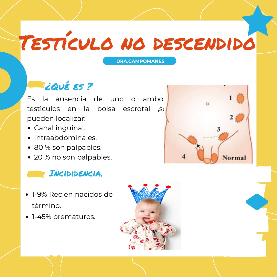 campomanesI's tweet photo. Testículo no descendido 
#uroped #criptorquidia #urology https://t.co/RlxKPQQACu