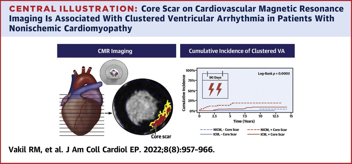 In patients w/ #NICM & scar on #whyCMR, core scar burden = strong predictor of clustered #ventriculararrhythmias, which have been associated w/ ⬆️ risk of mortality. More on this study from #EPeeps @DocVakil, @JonChrispinMD, @KathyWuMD et al in #JACCCEP bit.ly/3QTv6ah