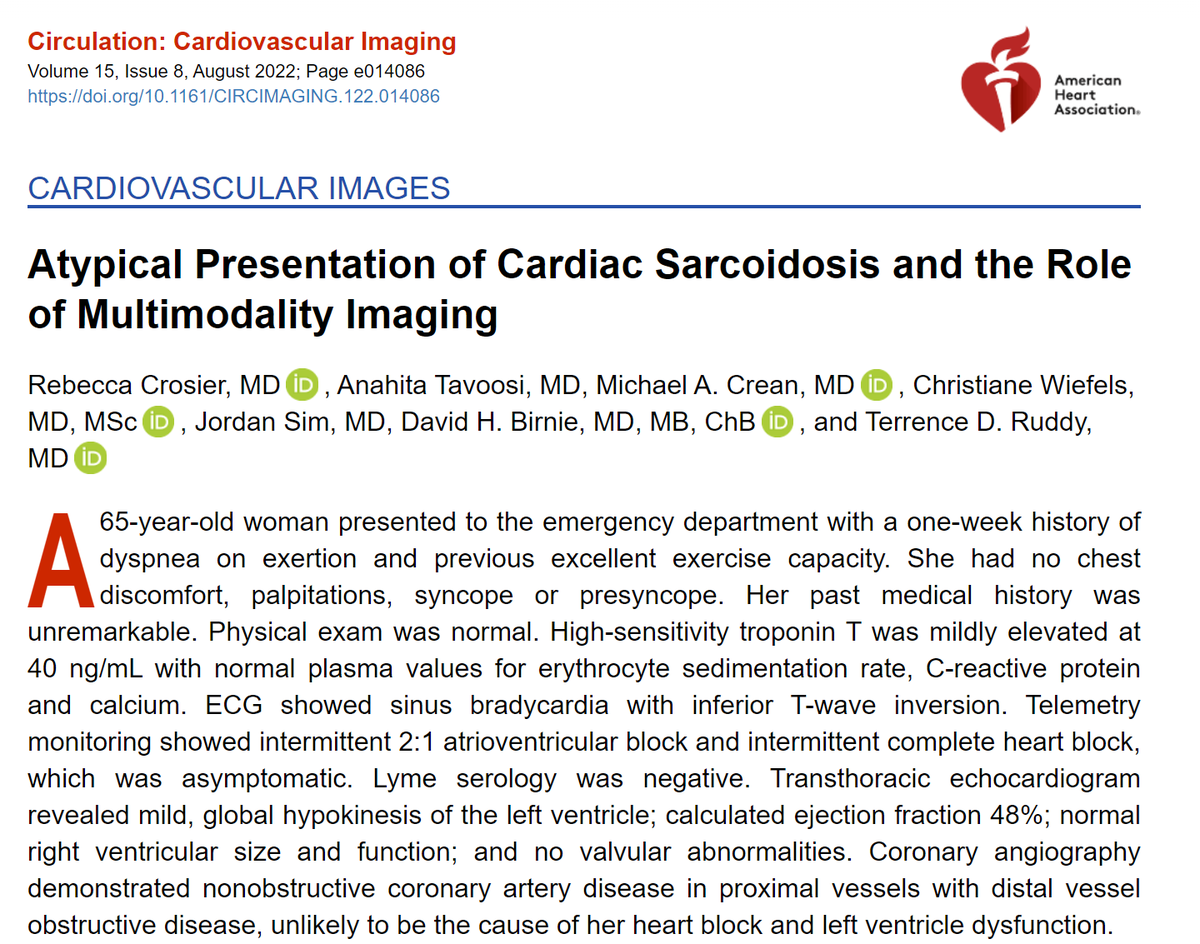 MasriAhmadMD's tweet photo. A new @CircImaging #CircImage of an atypical presentation of cardiac #Sarcoidosis 

#WhyCMR is show which was followed by #CVNuc #PET and biopsy 

Read more: https://t.co/8KB0MUcgLh 

#CardioTwitter https://t.co/CIPNfIJQ4I
