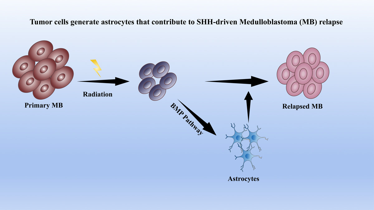 JExpMed's tweet photo. Duancheng Guo, et al. show that tumor cells in SHH-medulloblastoma can transdifferentiate into astrocytes to facilitate tumor recurrence. https://t.co/NgEPEK9I5X
From our Mechanisms & Models of #Cancer https://t.co/Qax0iqEzH9
#CSHLCancer22 https://t.co/LA1GcyW8EO