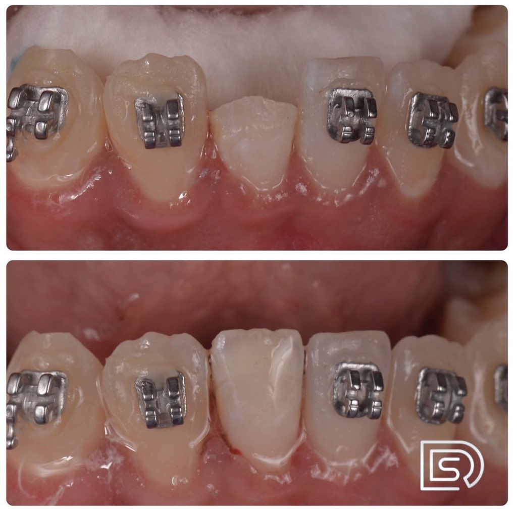 وكأن شيئاً لم يكُن 🤍✨
2u.pw/AzXCI