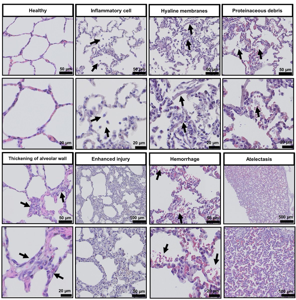New in #histopathology: 🔬🫁
A histopathological evaluation of large animal models of acute lung injury using a semi-quantitative scoring system 
🌎 + green innovations to traditional histological workflows
👉bit.ly/3T5sGY1

By <a href="/irnaugusto/">Iran Augusto</a>, <a href="/DWagnerLab/">DWagnerLab</a>, et al.