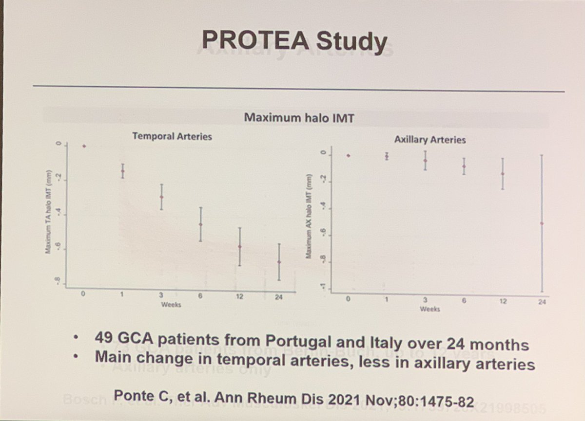 catysanchez00's tweet photo. 2nd North American LVV US workshop. 
✔️improvement of Halo sign ➡️ more rapid in temporal than in axillary arteries.
✔️Patients with GCA-LVV: worse outcomes #MayoClinicRheumatology.
✔️Lots of great hand on practice.
@USSONAR_Rh @MdWarrington @UWRheum https://t.co/MW23ed24p0