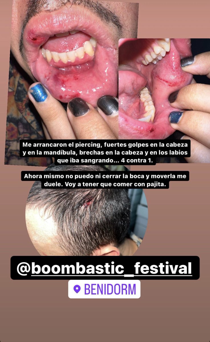 Hi ha drag + enllà de RuPaul #TeamHornella tweet media