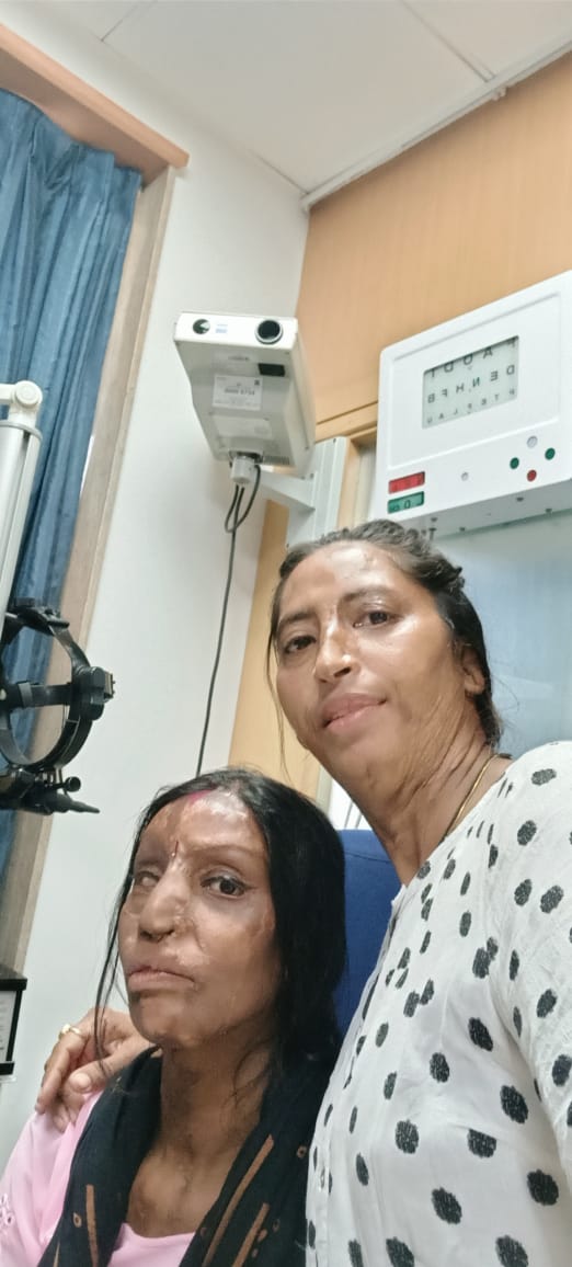 assfindia's tweet photo. Lalita got her eyes tests will help of ASSF.

Follow @assfindia

#assfindia #acidattack #acidattacksurvivors #acidattackindia

#ngo #donate #helpinghand #nonprofit #nonprofits #aid #charity #nonprofitworking #volunteerism #helpingothers #helpinghand #specialneeds #aids #acidburns https://t.co/gNNWZln9QG