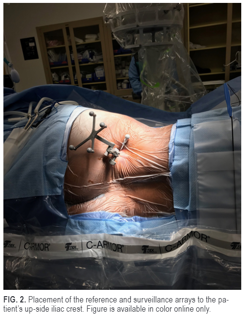TheJNS's tweet photo. #FreeArticle: Article of a CT-based comparative assessment of the accuracy of lateral versus prone robot-assisted percutaneous pedicle screw placement
https://t.co/D8cSIFeugp https://t.co/yVtL4uqXBD