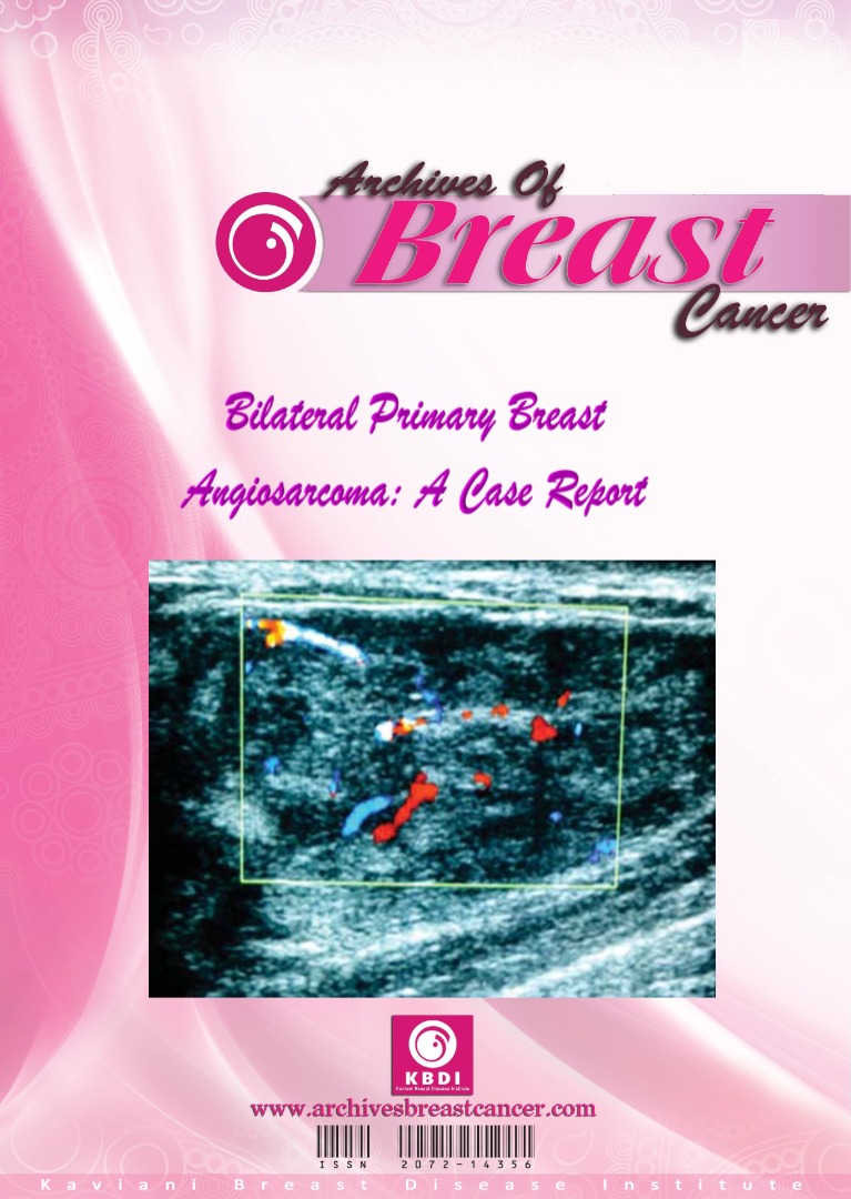 ArchBreastCan's tweet photo. Angiosarcoma can develop in all parts of the body containing blood vessels, including breast. Statistically, less than 10% of all angiosarcomas originate in the breast. Angiosarcoma accounts for less than 0.05% of breast primary cancers. Primary angiosarcoma develops/1 https://t.co/4pZDexQuJm