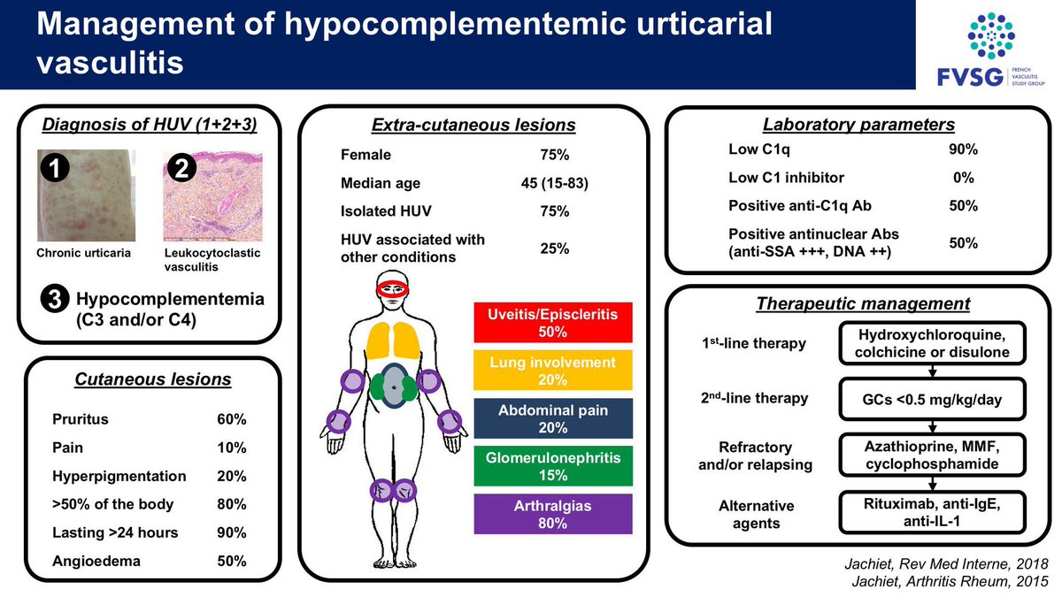 Diagnosis and management of hypocomplementemic urticarial vasculitis #vasculitis #urticarial #HUV #FVSG #GFEV