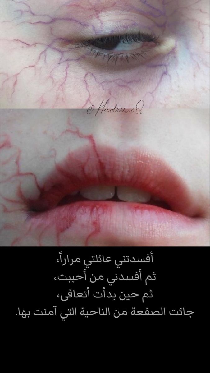 Be511__'s tweet image. 