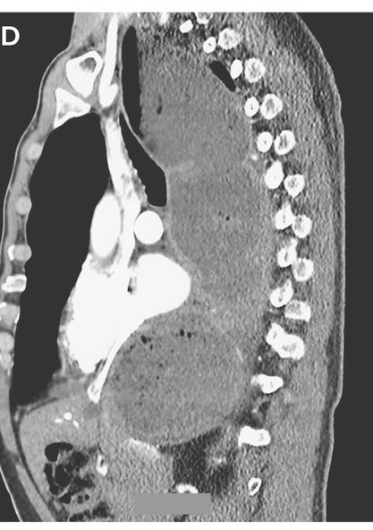 Avraham Z. Cooper, MD 🩺 tweet media