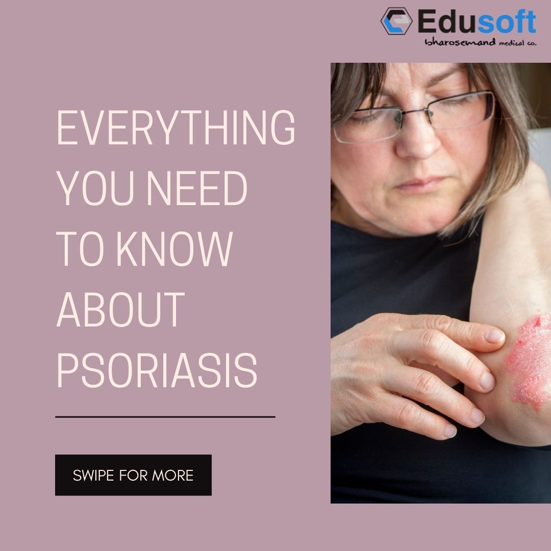 Edusoft_Health's tweet photo. Learn about Psoriasis Disease. If you experience any symptoms, consult a doctor at the earliest.
#psoriasis #PsoriasisAwarenessMonth #edusoft #edusofthealthcare https://t.co/KFG7PGbWy5