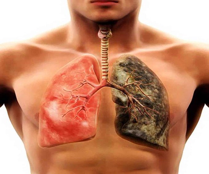 كيف تقومون بتنظيف كامل للرئتين من السموم بطرق طبيعه خصوصاً للمدخنين؟

تحت هذه التغريده ساتحدث عن طرق طبيعية منزلية لتنظيف الرئتين من السموم في ايام !
تابع السرد.
.
نصيحة : اذا مشغول فضلها وارجع لها بعدين❤️