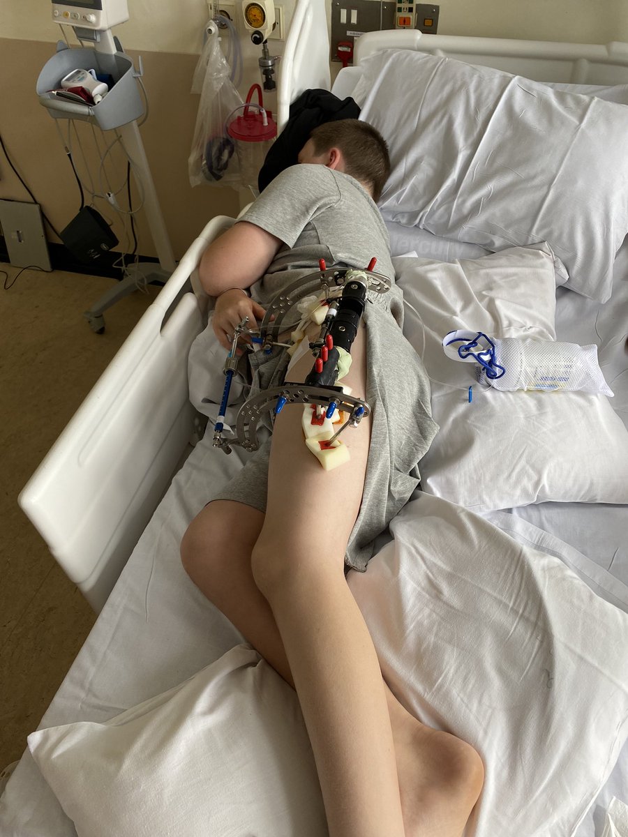 JillNic14's tweet photo. Day 5 post op, lots of tears but we have progress and he is starting to move. Hopefully tomorrow brings less pain and more movement. #pertheswarrior #perthesdisease #pertheskid https://t.co/n3rqPPeDKA