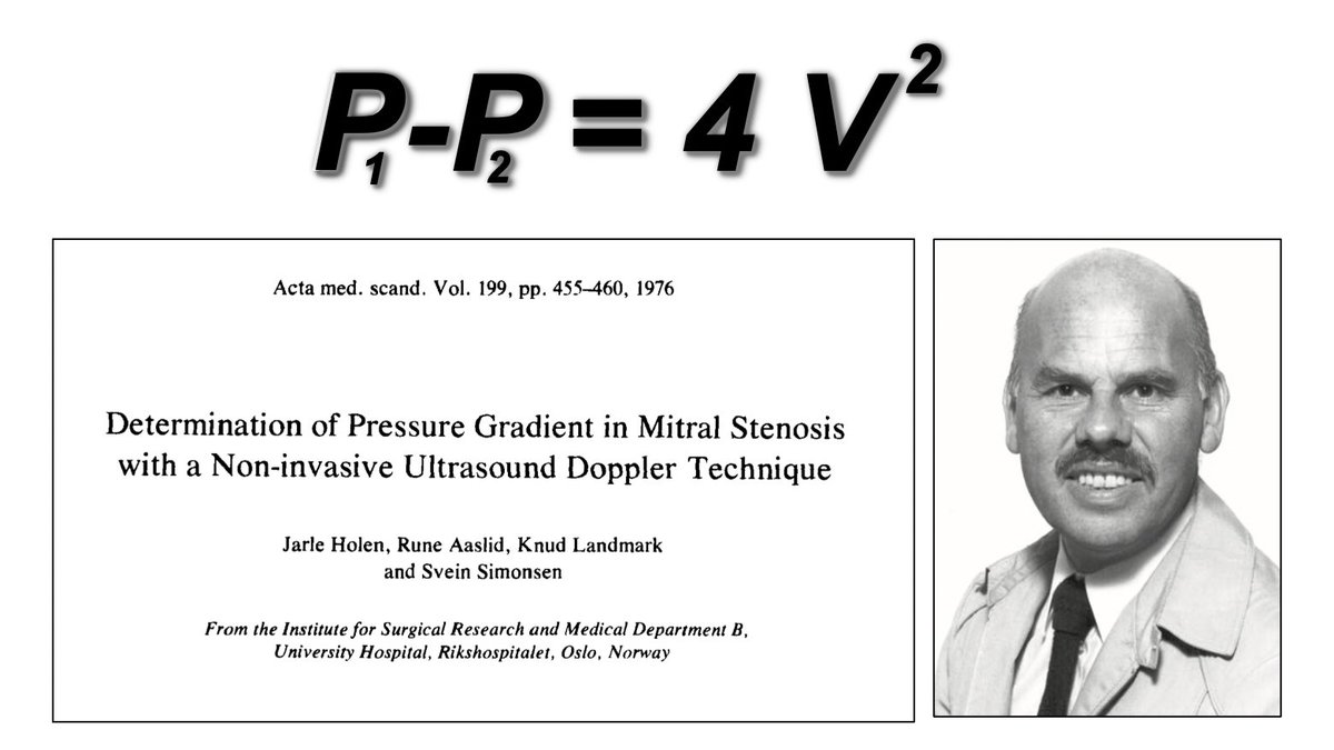 #TrabajosEstelaresEcocardiografia.
Entre los cinco trabajos mas importantes de la historia del Eco Doppler
Acta Med Scand  1976 : El Noruego J. Holen describe  el uso de teorema simplificado de Bernouille para el cálculo de los gradientes:
!!!Nacía el Doppler cuantitativo¡¡