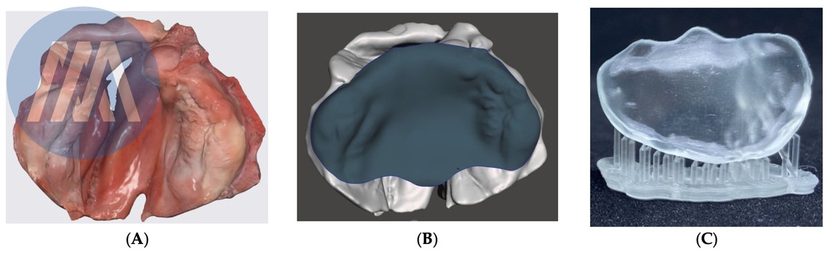 Congratulations to all co-authors. The new collaborative paper 'A Point-of-Care Digital Workflow for 3D Printed Passive Presurgical Orthopedic Plates in Cleft Care' has just been published: mdpi.com/2227-9067/9/8/… #cleftlip #cleftpalate; #3Dprinting #CAD...