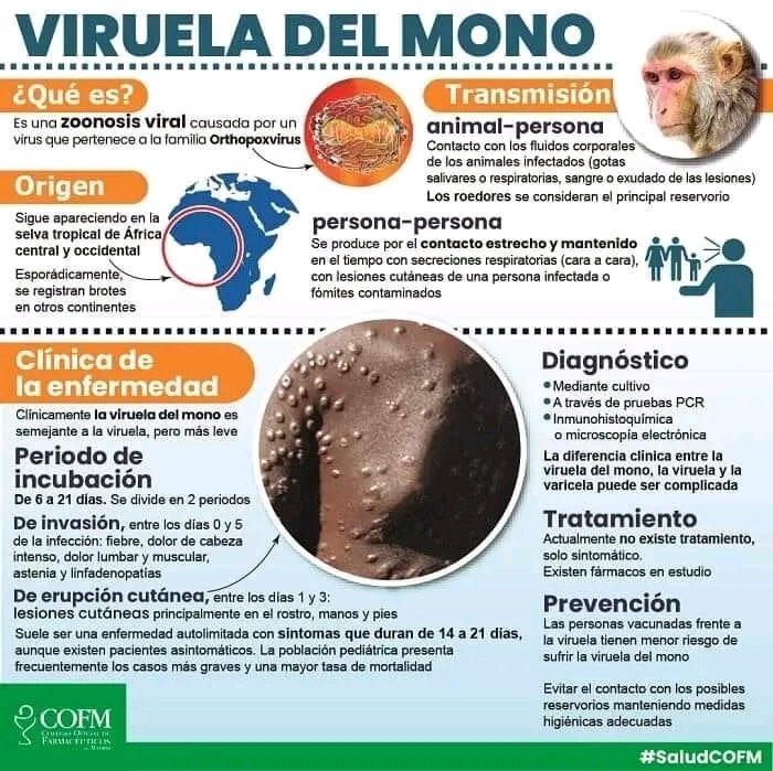 Es importante estar informados y alertas ante el primer caso detectado en #Cuba de viruela símica.

<a href="/DPSHabana/">Dirección General de Salud La Habana</a> <a href="/YanetHzP/">Yanet Hernández Pérez</a> <a href="/gobhabana/">Gobierno La Habana</a> <a href="/RGZapata500/">Reinaldo García Zapata</a> <a href="/PresidenciaCuba/">Presidencia Cuba 🇨🇺</a> @RadioCOCOnline <a href="/TribunaHabana/">Tribuna de La Habana</a> <a href="/infocaphabana/">InfoCAP</a> <a href="/Giorvys1/">Giorvys Taquechel Román</a> <a href="/mora_aly/">Aly Martinez Mora</a> <a href="/raul_vantroi/">Raúl Vantroi Navarro Martínez</a>