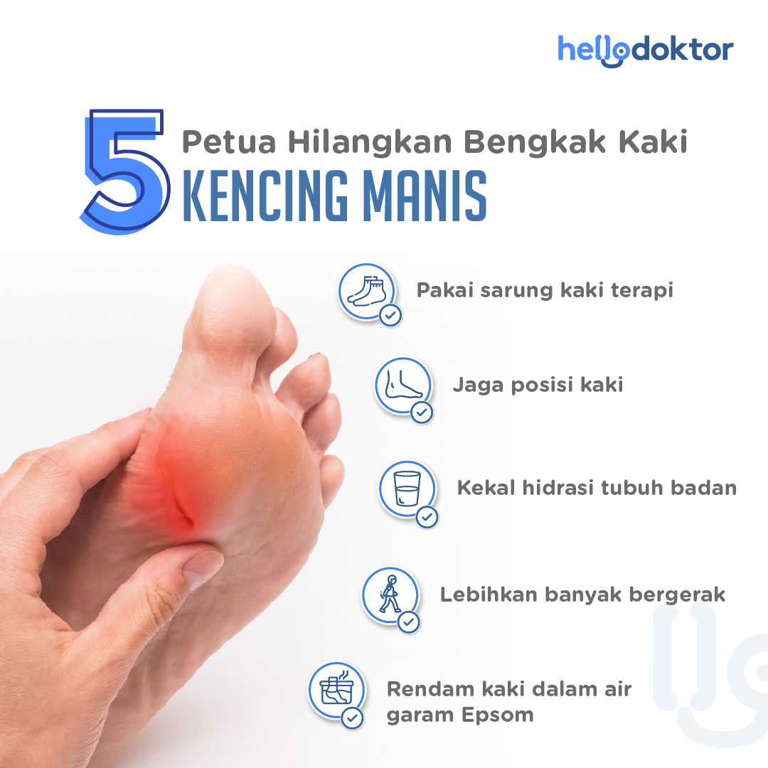 HelloDoktor's tweet photo. Sekiranya kondisi ini terjadi kepada anda, jangan berdiam diri je dan cepat-cepatlah jumpa doktor untuk bincang tentang segala ubatan, rawatan atau tindakan yang perlu.
#hellodoktormy #kencingmanis #diabetes
Anda juga boleh cuba petua hilangkan bengkak kaki kencing manis ini π https://t.co/cs9pp4oVxA