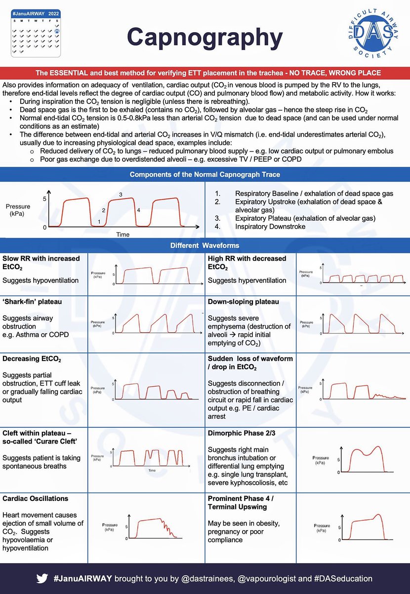 Capnography overview #BJHM #MedEd #FOAMed #Medtwitter #Criticalcare #Emergencymedicine #ICU #capnography