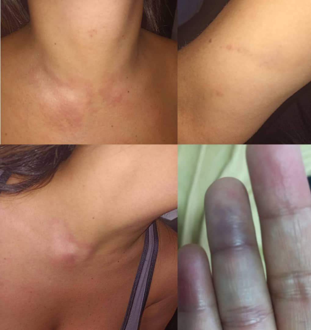 rcamachovzla's tweet photo. #Caracas Funcionarios de la DIP de la PNB detuvieron a un sujeto, identificado como Nestor Salazar, por presuntamente agreder salvajemente a su ex pareja en un apartamento en Ciudad Tiuna. Vecinos relataron que Salazar se encontraba en el apartamento y escucharon una discusión https://t.co/63VjszRWLL