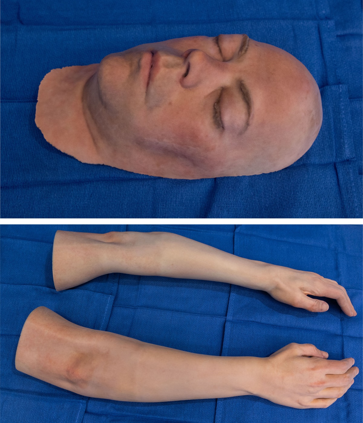 Plastic and Reconstructive Surgery on Twitter "Trending in PRS The